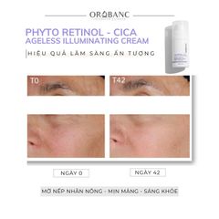 Kem dưỡng trẻ hóa, căng bóng da | PHYTO RETINOL - CICA AGELESS ILLUMINATING CREAM OROBANC