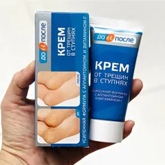 Kem Kpem Giảm Và Phục Hồi Nứt Nẻ Gót Chân Kpem 50ml xuất xứ Nga