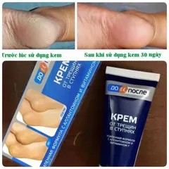 Kem Kpem Giảm Và Phục Hồi Nứt Nẻ Gót Chân Kpem 50ml xuất xứ Nga