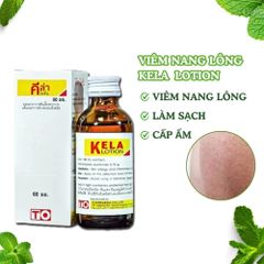 Viêm nang lông Kela Viêm Lỗ Chân Lông Giảm Viêm Lỗ Chân Lông dung tích 60ml
