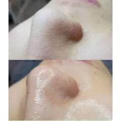 Ủ mụn đầu đen Removes BlackHeads dung tích 50ml
