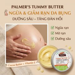 Kem ngừa rạn da bụng Palmer's Tummy Butter for Stretch Marks dưỡng ẩm sâu tăng đàn hồi 125g