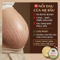Kem ngừa rạn da bụng Palmer's Tummy Butter for Stretch Marks dưỡng ẩm sâu tăng đàn hồi 125g