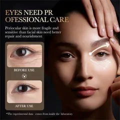 Kem dưỡng mắt Xóa thâm quầng mắt và tinh chất chống lão hóa mắt Kem dưỡng mắt chống nhăn 30g
