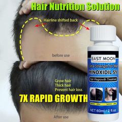 Dung dịch làm dày tóc Minoxidil 5% (60ml/chai)Dầu râu mọc tóc mọc tóc để Hair Growth