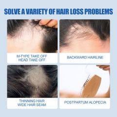 Dung dịch làm dày tóc Minoxidil 5% (60ml/chai)Dầu râu mọc tóc mọc tóc để Hair Growth