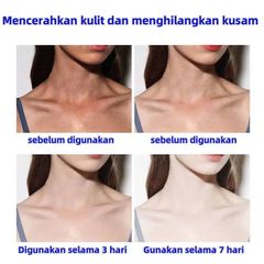 Kem dưỡng ẩm vitamin E kết hợp Hoa Anh Thảo 400ML