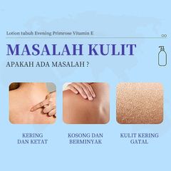Kem dưỡng ẩm vitamin E kết hợp Hoa Anh Thảo 400ML