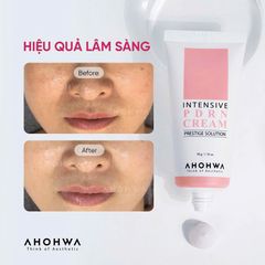 AHOHWA PDRN CREAM – KEM PHỤC HỒI ĐA TẦNG, TÁI TẠO DA TỪ GỐC 50G