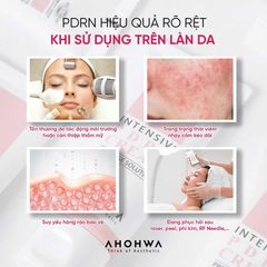 AHOHWA PDRN CREAM – KEM PHỤC HỒI ĐA TẦNG, TÁI TẠO DA TỪ GỐC 50G