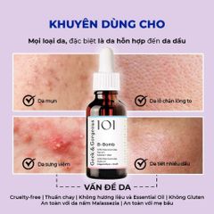 (Châu Âu) Tinh Chất Kiềm Dầu, Hỗ Trợ Kháng Viêm, Cải Thiện Mụn Geek & Gorgeous B-Bomb 10% Niacinamide