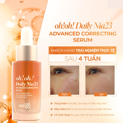 Serum Niacinamide OhOh 23 Daily Nia 23 Correcting Dưỡng Sáng Mờ Thâm 30ml