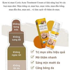 Kem Giảm Mụn Cấp Tốc Loại Bỏ Mụn và Vết Thâm Hoàn ToànThu Nhỏ Lỗ Chân Lông CYSTIC Acne Giúp DaLáng Mịn Khít Lỗ Chân Lông