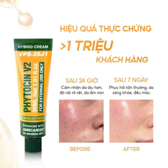 Kem Dưỡng PHYTOCIN V2 Phục Hồi Cấp Ẩm Da - Phytocin V2 Hybrid Cream 30ml