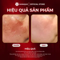 SHINIQUE MELA Skin Whitening Cream - Kem Dưỡng Da Hỗ Trợ Cải Thiện Nám và Không Đều Màu, Dưỡng Sáng Da - 30g