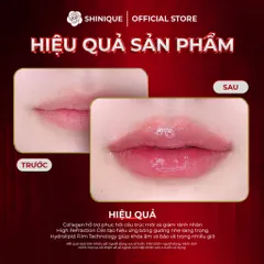 SHINIQUE Collagen Lip Balm 9g - Son Dưỡng Môi Collagen Kết Hợp Vitamin Giúp Phục Hồi, Giữ Ẩm và Bảo Vệ Môi Suốt 24h