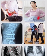 (COMBO 2 HỘP TIẾT KIỆM 25%) Miếng Dán  Giảm Đau Lưng hỗ trợ thư giãn cơ thể
