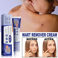 Kem Bôi Rụng Mụn Thịt Thừa & Mụn Cóc 20g 