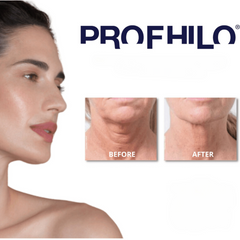 Tinh chất BAP PROFHILO Nâng Cơ Trẻ Hóa Chính Hãng Italia.