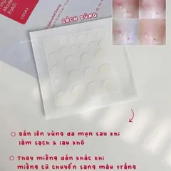 Miếng dán mụn COSRX – hỗ trợ bảo vệ vùng da mụn 664656