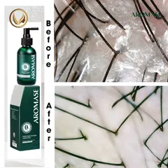 Xịt dưỡng tóc, chăm sóc da đầu AROMASE Herbal Scalp Care Spray 40ml - cho da đầu khô
