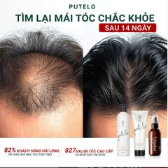 Bộ dầu gội & xả thực vật, trẻ hóa da đầu, giảm rụng, hỗ trợ mọc tóc – Putelo AR – Chính hãng Nhật Bản