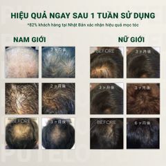 Bộ dầu gội & xả thực vật, trẻ hóa da đầu, giảm rụng, hỗ trợ mọc tóc – Putelo AR – Chính hãng Nhật Bản