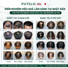 Tinh chất dưỡng da đầu, hỗ trợ mọc tóc, giảm rụng và phục hồi - Putelo AR Essence Uprise 140ml - Chính hãng Nhật Bản