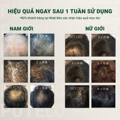 Dầu xả cho tóc rụng, cấp ẩm, tái sinh 3 tầng da đầu, giúp tóc chắc khỏe PUTELO Hair Scalp Pack 240g từ NHẬT