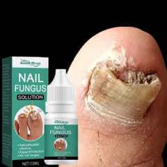 Serum loại bỏ nấm móng Tinh chất phục hồi móng 10ml Serum phục hồi móng Móng kháng khuẩn chân loại nấm móng gãy