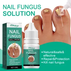Serum loại bỏ nấm móng Tinh chất phục hồi móng 10ml Serum phục hồi móng Móng kháng khuẩn chân loại nấm móng gãy