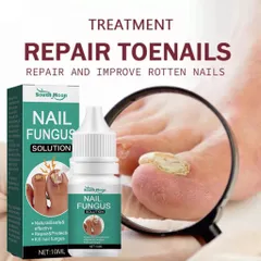 Serum loại bỏ nấm móng Tinh chất phục hồi móng 10ml Serum phục hồi móng Móng kháng khuẩn chân loại nấm móng gãy