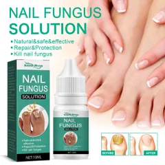 Serum loại bỏ nấm móng Tinh chất phục hồi móng 10ml Serum phục hồi móng Móng kháng khuẩn chân loại nấm móng gãy