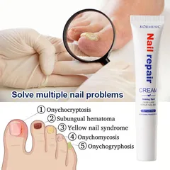 Kem loại bỏ nấm móng Tinh chất phục hồi móng 20g Kem phục hồi móng Móng kháng khuẩn chân loại nấm móng gãy móng chốn