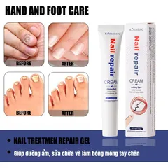 Kem loại bỏ nấm móng Tinh chất phục hồi móng 20g Kem phục hồi móng Móng kháng khuẩn chân loại nấm móng gãy móng chốn
