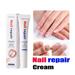 Kem loại bỏ nấm móng Tinh chất phục hồi móng 20g Kem phục hồi móng Móng kháng khuẩn chân loại nấm móng gãy móng chốn