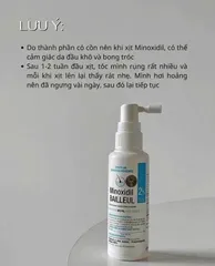 Xịt mọc tóc MINOXIDIL 2%-5%-Cứu tinh tóc mỏng, tóc hói cho mọi ngườiii