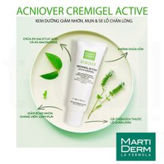 [HÀNG CÔNG TY] Martiderm Acniover Cremigel Active - Kem Dưỡng Giảm Mụn, Điều Tiết Bã Nhờn, Se Khít Lỗ Chân Lông 40ml