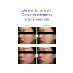 HÀNG CÔNG TY - Sữa dưỡng Dermafirm Soothing Repair Emulsion R4 phục hồi cho da tổn thương giãn mao mạch 120ml