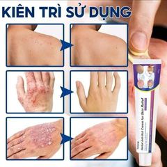 Bán chạy WJG kem Giảm ngứa do muỗi đốt hỗ trợ cải thiện các vấn đề da