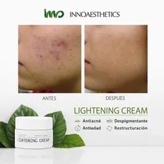 HÀNG CÔNG TY -Kem Inno Peel A Hoạt Chất Vitamin A 5% Innoaesthetics Inno LIGHTENING Tái Tạo Đều Màu Da Giảm Mụn Thâm Mụn