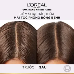 Bộ Gội Xả L’Oréal Paris Elseve Hyaluron 72H Pure/Moist 620ml 375ml - Tóc Mềm Mượt Nhẹ Bồng 720780