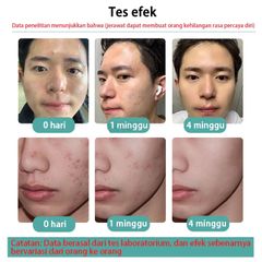 Sữa rửa mặt cho nam sạch dầu nhờn ngừa mụn Men Stay Simplicity Facial Cleanser 300ml