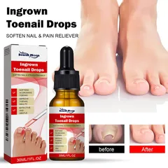 Serum nấm móng tay chân dưỡng cứng dài móng 