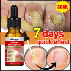 Serum nấm móng tay chân dưỡng cứng dài móng 