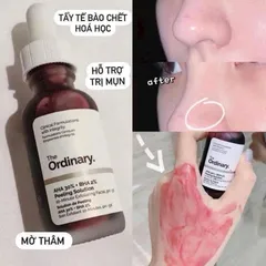 Serum The Ordinary AHA 30% + BHA 2% Peeling solution