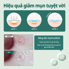 Miếng Dán Mụn Some By Mi Clear Spot Patch - 18 Miếng Bảo Vệ Da, Hút Nhân Mụn, Chống Nước, Dành Cho Da Nhạy Cảm 729412