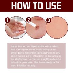 Gel thảoo dượcc: xoá nốt ruồi, mụn cóc, tàn nhang, mụn thịt – Lành tính, không đau, ngừa sẹo lồi ，Tiện lợi sử dụng tại nhà