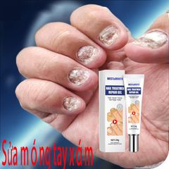 Kem nấm móng móng tay chăm sóc Nấm móng tay 20g Cải thiện vết nứt móng tay giảm nhiễm nấm kích thích mọc