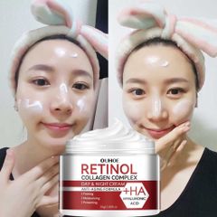 Kem dưỡng Retinol Kem nám tàn nhang chấm tàn nhang kem trắng da mặt 30g Loại bỏ nám tàn nhang làm trắng sáng da dưỡng ẩm